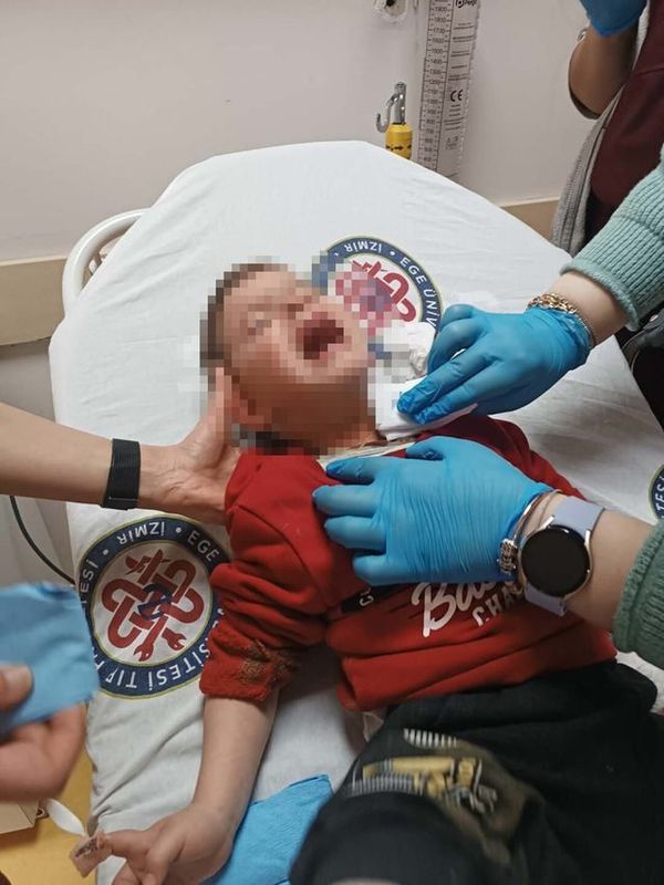 İzmir Karabağlar'da Bıçaklı Saldırı: 2 Yaşındaki Çocuk Hafif Yaralandı